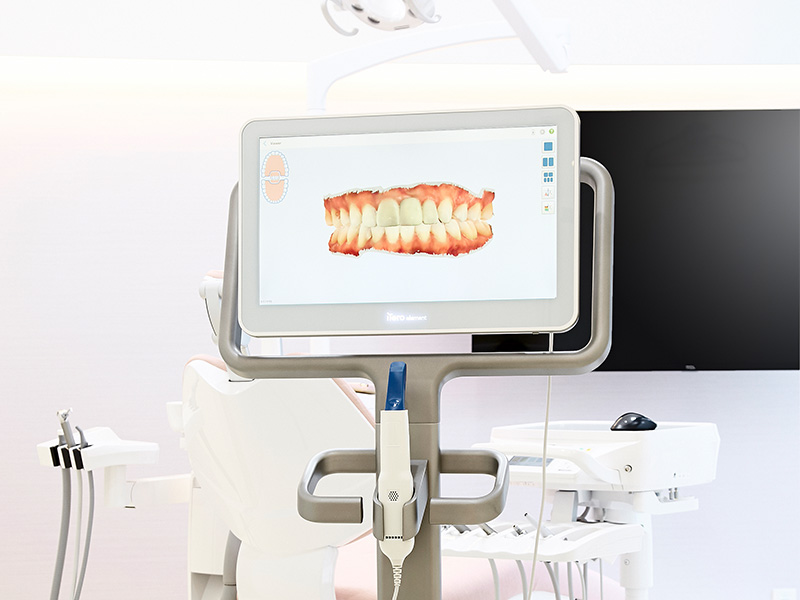 光学印象(デジタルスキャナ)