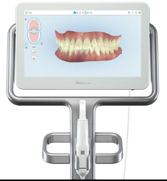インビザライン精密検査